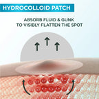 Garnier Skin Active Fast Clear Invisible Pimple Patch 8 Hours Hydrocolloid