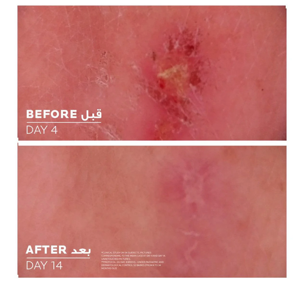 La Roche Posey Cicaplast Balm B5+
