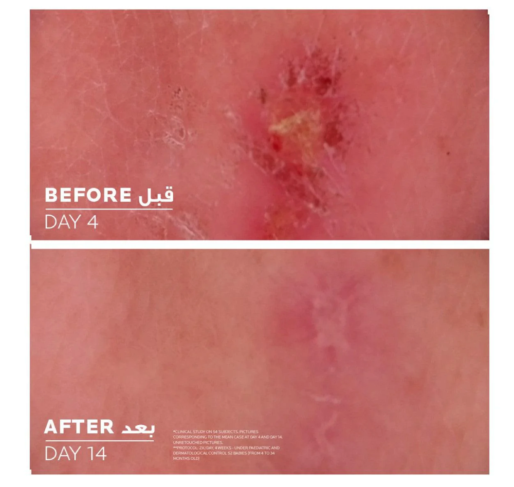 La Roche Posey Cicaplast Balm B5+