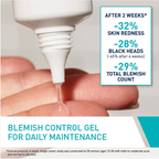 Cerave Blemish Control Gel Facial Moisturizer For Acne & Blemishes with Glycolic Acid and Lactic Acid AHA/BHA