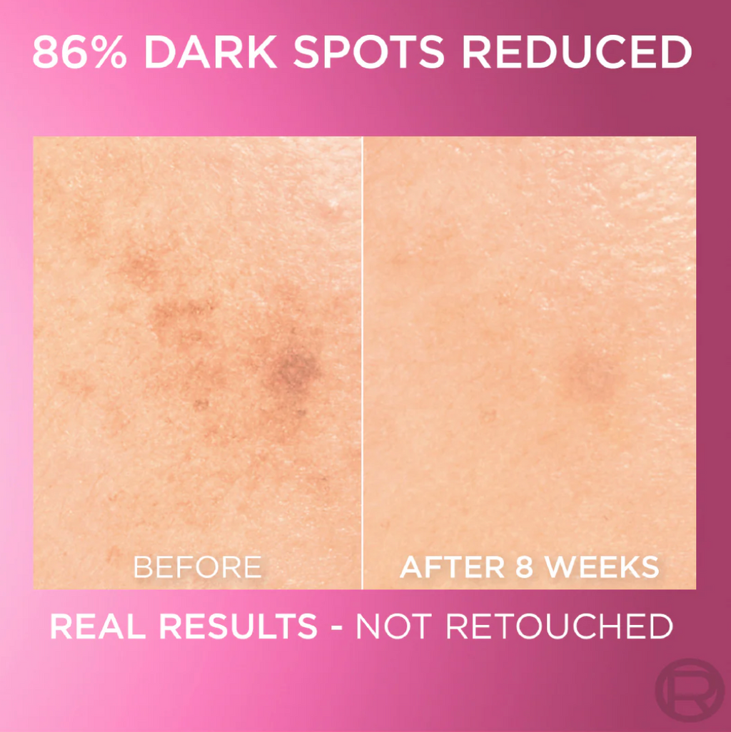 L’Oréal Paris Glycolic Bright Serum with 8% [Melasyl ™ + Glycolic Acid + Niacinamide] face serum for Dark Spots & Brightening