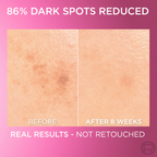 L’Oréal Paris Glycolic Bright Serum with 8% [Melasyl ™ + Glycolic Acid + Niacinamide] face serum for Dark Spots & Brightening