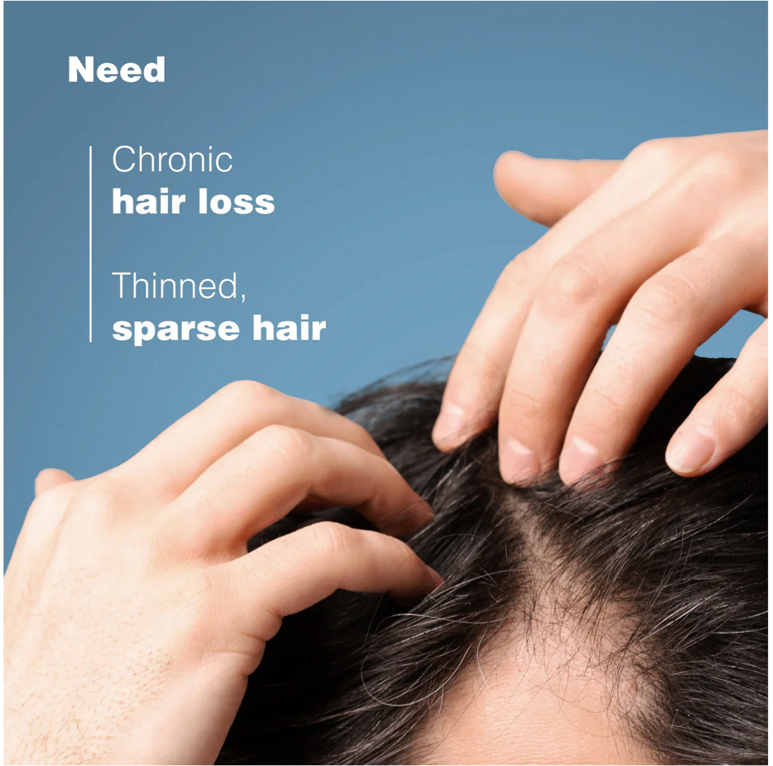 Ducray Anaphase Anti-Hair Loss Anti-Thinning Shampoo
