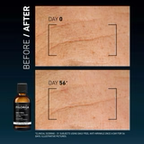 Filorga Wrinkles Daily Peel Anti-Wrinkle Resurfacing Solution