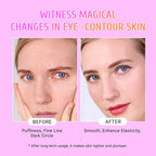 PEAUAMIE Under Eye Patches Gold, Rose and Hyaluronuc acid Eye Masks